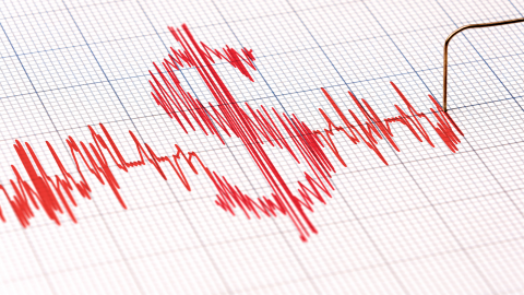 heart monitor print out with dollar symbol.